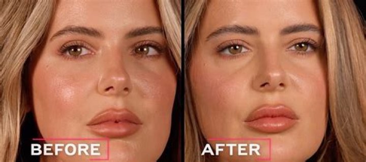 brielle biermann lips dissolving