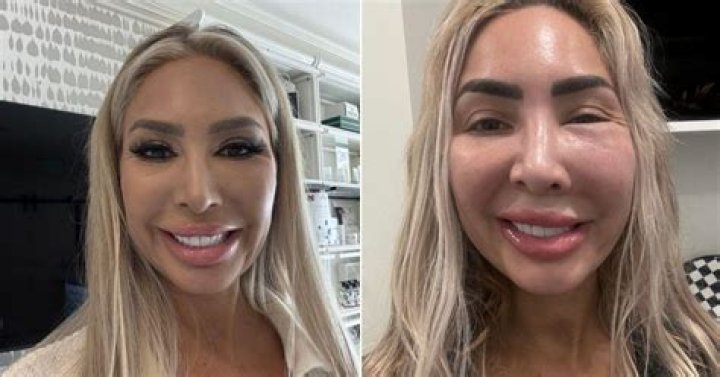 Farrah Abraham Botched