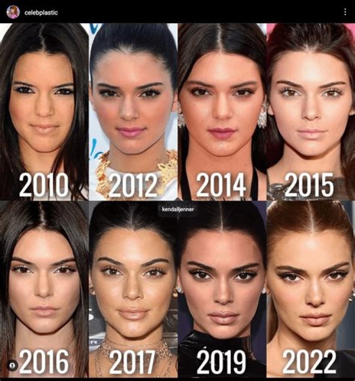 Kendall Jenner Then & Now