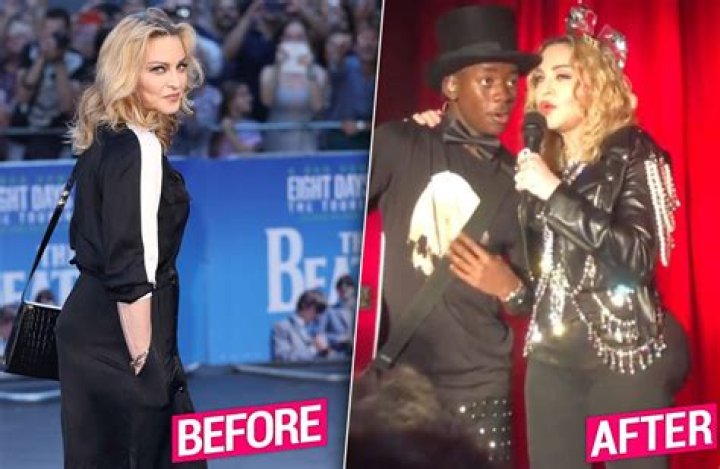Madonna butt implants