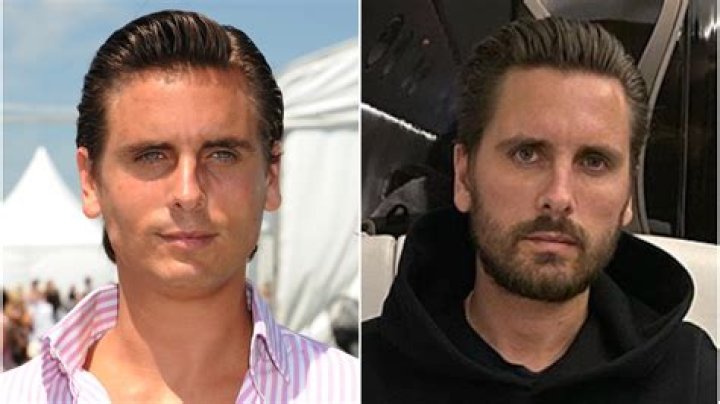 Scott Disick Then & Now