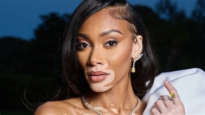 Winnie Harlow